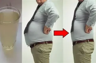  إزالة الكرش