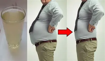  إزالة الكرش